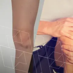 Anatomia kolana po lewej, a po prawej osoba trzymająca się za bolące kolano.
