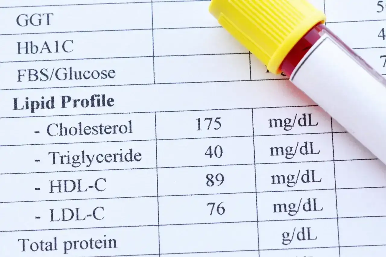 Lipidogram - Jak interpretować wyniki i co dalej robić?