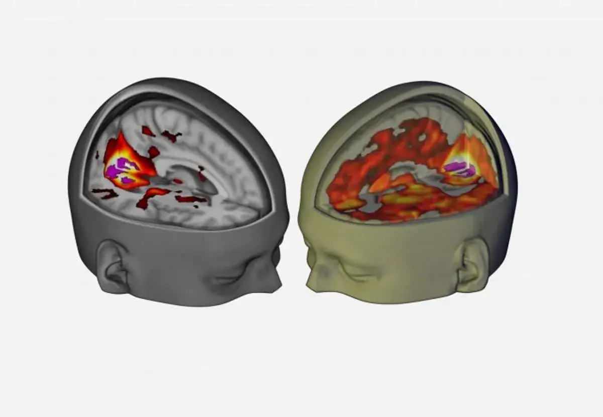 Dwa przekroje mózgu z aktywnością neuronową, być może po zażyciu DMT.