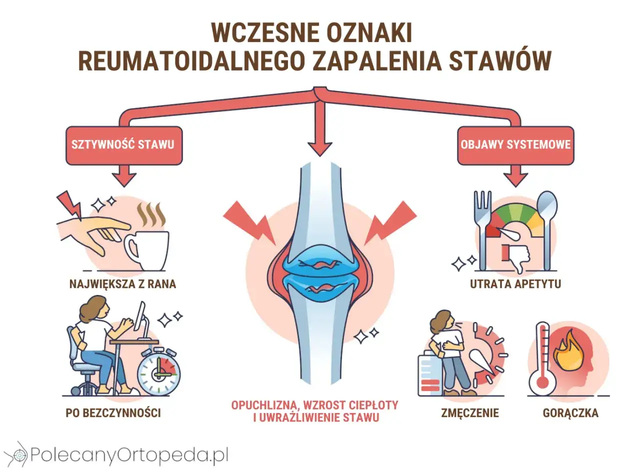 Wczesne objawy RZS: sztywność stawów, utrata apetytu, zmęczenie, gorączka. Konsultacja z reumatologiem jest kluczowa.