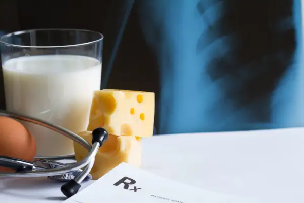 Szklanka mleka, ser, jajko i stetoskop na tle zdjęcia rentgenowskiego. Zdrowa dieta bogata w wapń jest kluczowa dla mocnych kości.